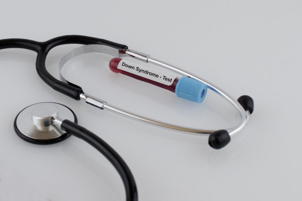 唐氏综合征血检图片下载