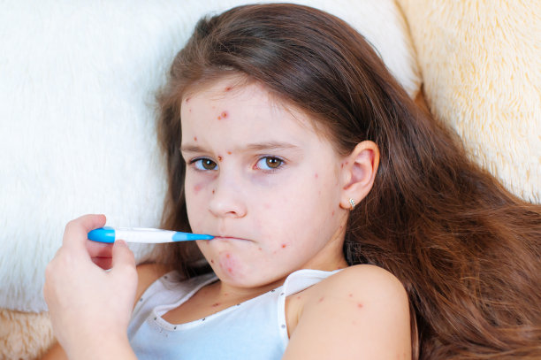 可爱的悲伤小女孩的特写。水痘病毒或水痘泡疹的儿童素材图片