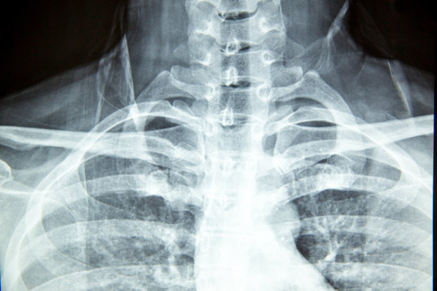 近距离x线片显示颈椎或颈椎、颈骨x线片。放射学教育人体解剖学。图片下载