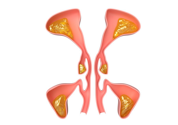 有鼻窦炎，面部发炎，引起头痛及不适。三维渲染图片下载