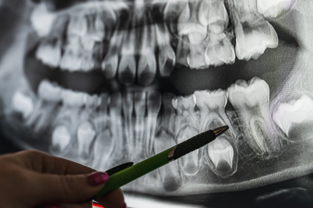 牙科x光图片下载
