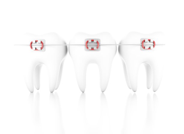 3d牙带支架图片下载