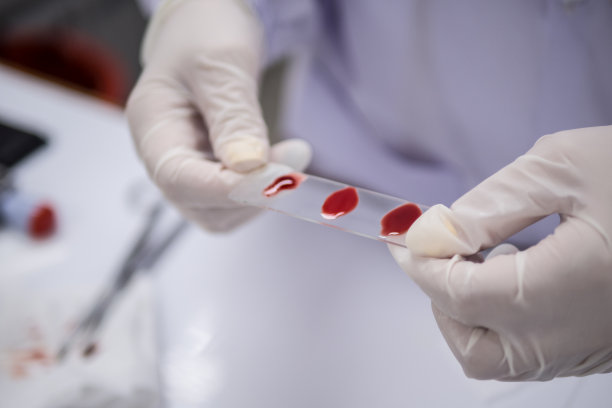 科学家在实验室检查血型图片下载