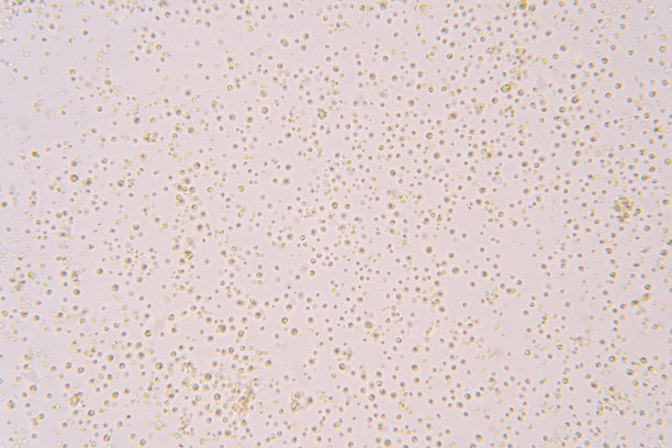 小球藻是属于绿藻门的单细胞绿藻属。图片下载