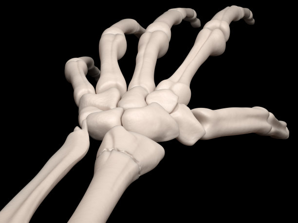 腕关节外骨折，桡骨远端无移位骨折图片下载