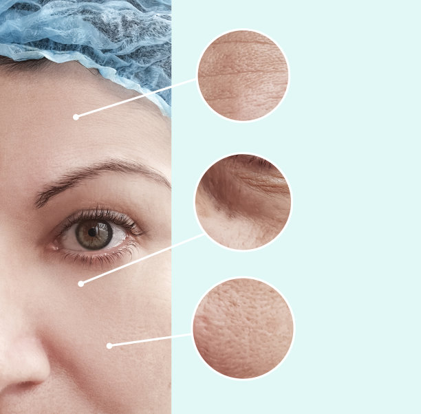 女人皱纹的前后程序，拼贴图片下载