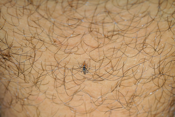 蚊子咬人的腿图片下载