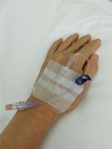 左手上有生理盐水锁，用来吃药图片下载