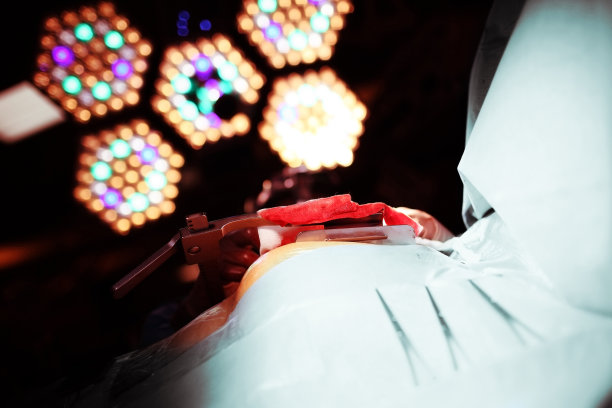 令人生畏的手术灯光与手术过程的恐惧有关图片下载