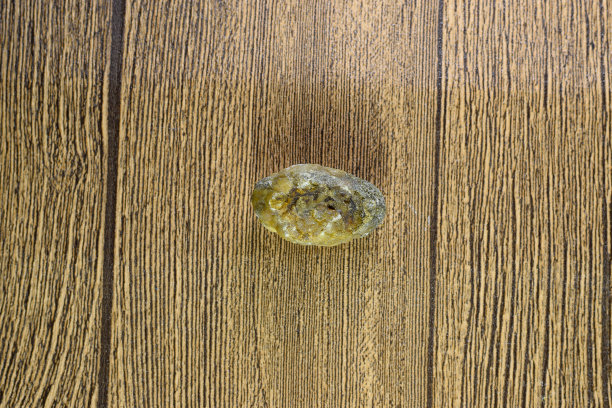 大号胆结石，胆囊结石，胆结石的结果，异质成分的结石图片下载