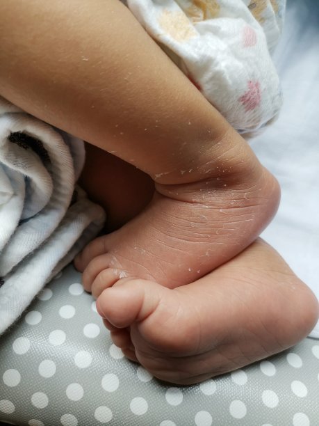 新生儿的脚图片下载