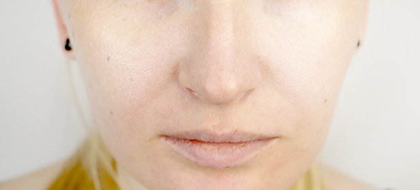 年轻漂亮的金发女人，嘴唇干燥图片下载