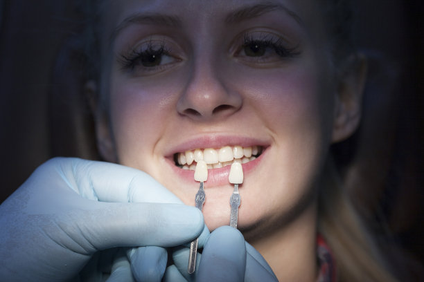 美丽的微笑和洁白的牙齿，一个年轻女子图片下载