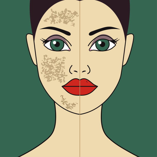 甲状腺正常肿大图片下载