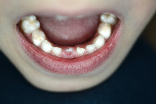 新牙齿图片下载