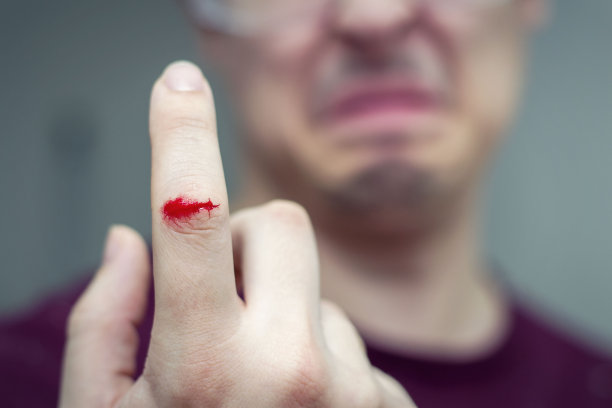 那人手上带血的伤口是手指上的伤口。用于治疗伤口的贴片。安全。疼痛。图片下载
