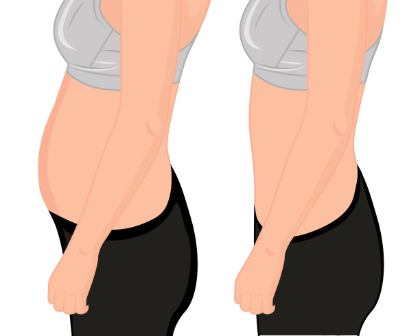 又胖又瘦的女孩。脂肪的腰。抽脂。之前和之后。女人身体校正矢量插图图片下载