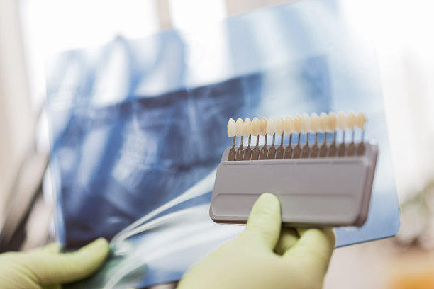 牙医拿着牙齿的x光片图片下载