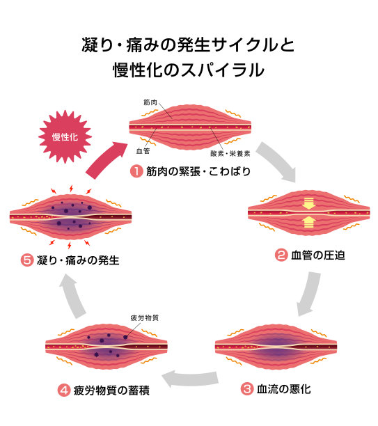 僵硬和痛苦的循环，编年史插图/日文螺旋图片下载