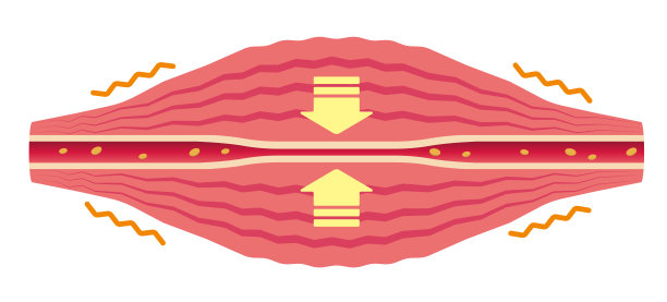 血管受压(无文字)。肌肉和血管的平面插图。图片下载