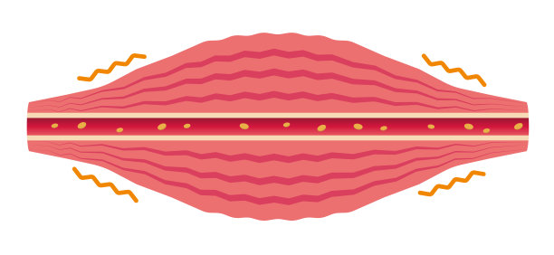 肌肉变得紧张(没有文字)。肌肉和血管的平面插图。图片下载