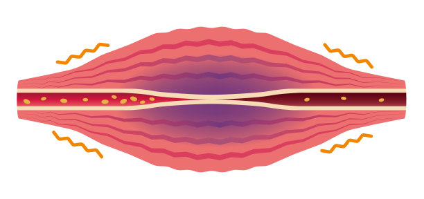 血流更糟(没有文字)。肌肉和血管的平面插图。图片下载