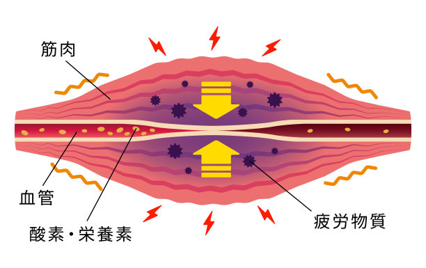 出现填充物和疼痛(日语)。肌肉和血管的平面插图。图片下载