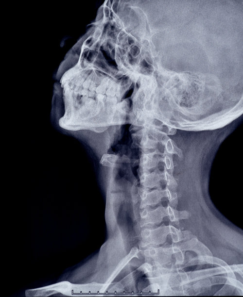 头骨x射线图像图片下载