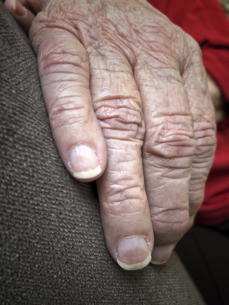 特写一位老妇人布满皱纹的双手图片下载