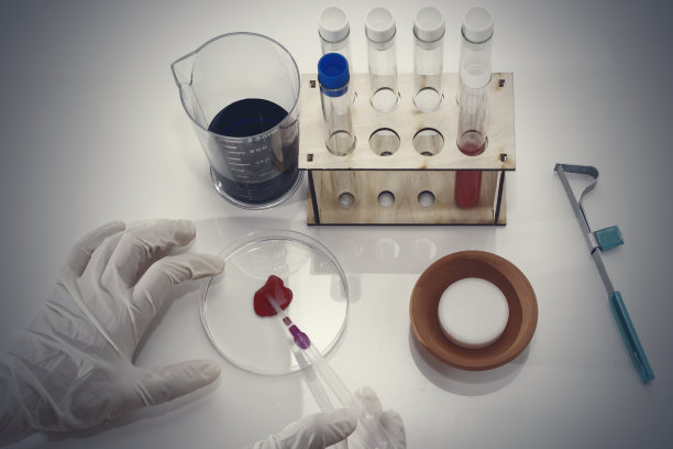 医生的手用血样、小瓶和烧瓶工作。图片下载