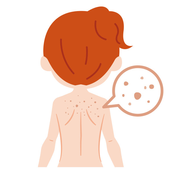 背部痤疮疤痕毛孔污渍女性图片下载