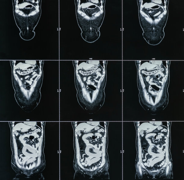 MRI扫描人体腹部断层扫描图片下载
