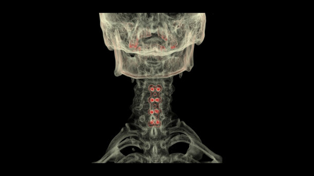 颈椎三维CT扫描图片下载
