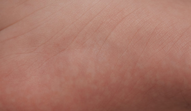 带线条的皮肤纹理图片下载