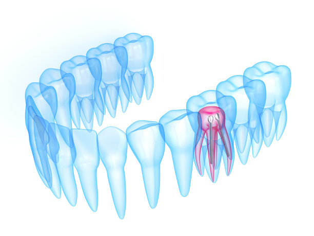 3d渲染的x射线牙齿与不锈钢牙科柱图片下载