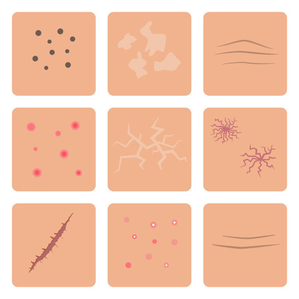 皮肤问题的概念。图片下载