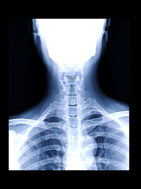 颈椎x线片或颈椎AP片用于诊断椎间盘突出和颈椎病。图片下载