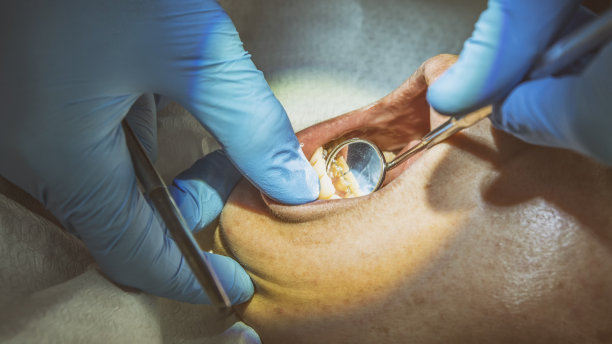 近距离拍摄的牙医检查牙齿图片下载