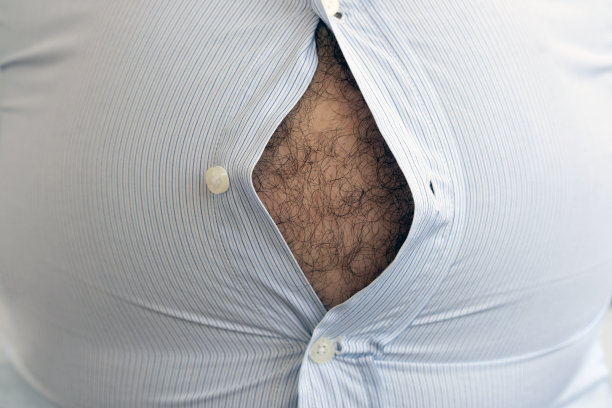 人超重。这张照片是啤酒肚、节食失败和吃错食物的象征。减肥的概念。紧的衬衫。图片下载