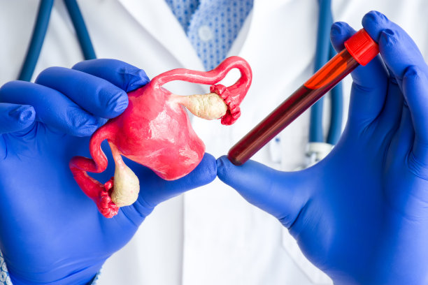 实验室医学诊断，卵巢和生殖系统激素检测概念照片。医生或实验室技术员一只手拿着实验室试管，另一只手拿着血液和子宫图片下载