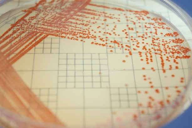 粘质沙雷氏菌条纹板图片下载