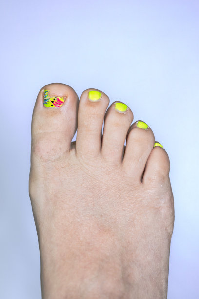 近距离破碎的趾甲与可爱的绘制。即使脚趾甲被弄坏了，女人还是很有趣，很积极。立式、单图片下载