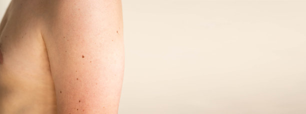 近距离观察一个男人裸露的背部皮肤，上面有零星的痣和雀斑。检查良性的痣。阳光对皮肤的影响图片下载