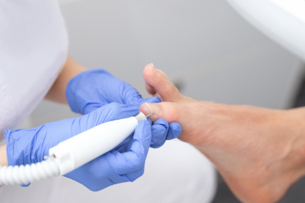 修脚治疗上的男足特写图片下载