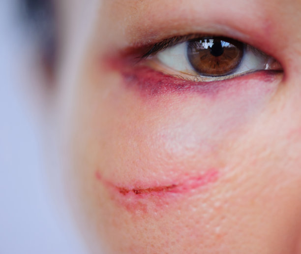 家庭暴力受害者的悲伤眼神图片下载