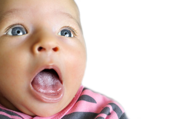 婴儿舌上的白色弯曲斑点(念珠菌属)图片下载