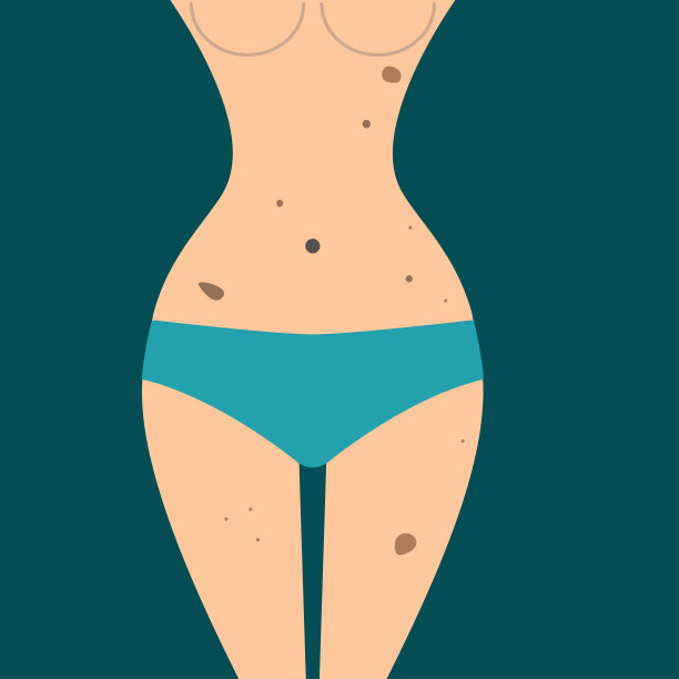 身体抽脂术[转换]图片下载