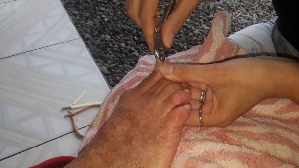 用癣做指甲修脚图片下载