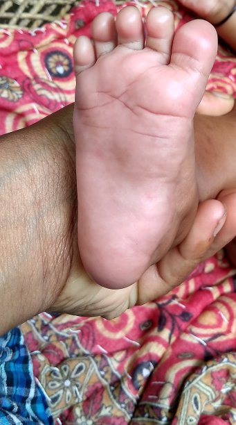 宝宝的脚图片下载