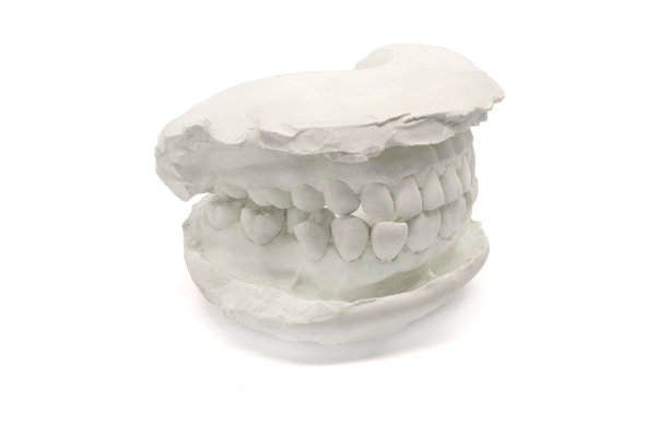 牙科模型石膏白色背景，孤立。石膏模型颌骨与人工牙科设计与裁剪路径图片下载